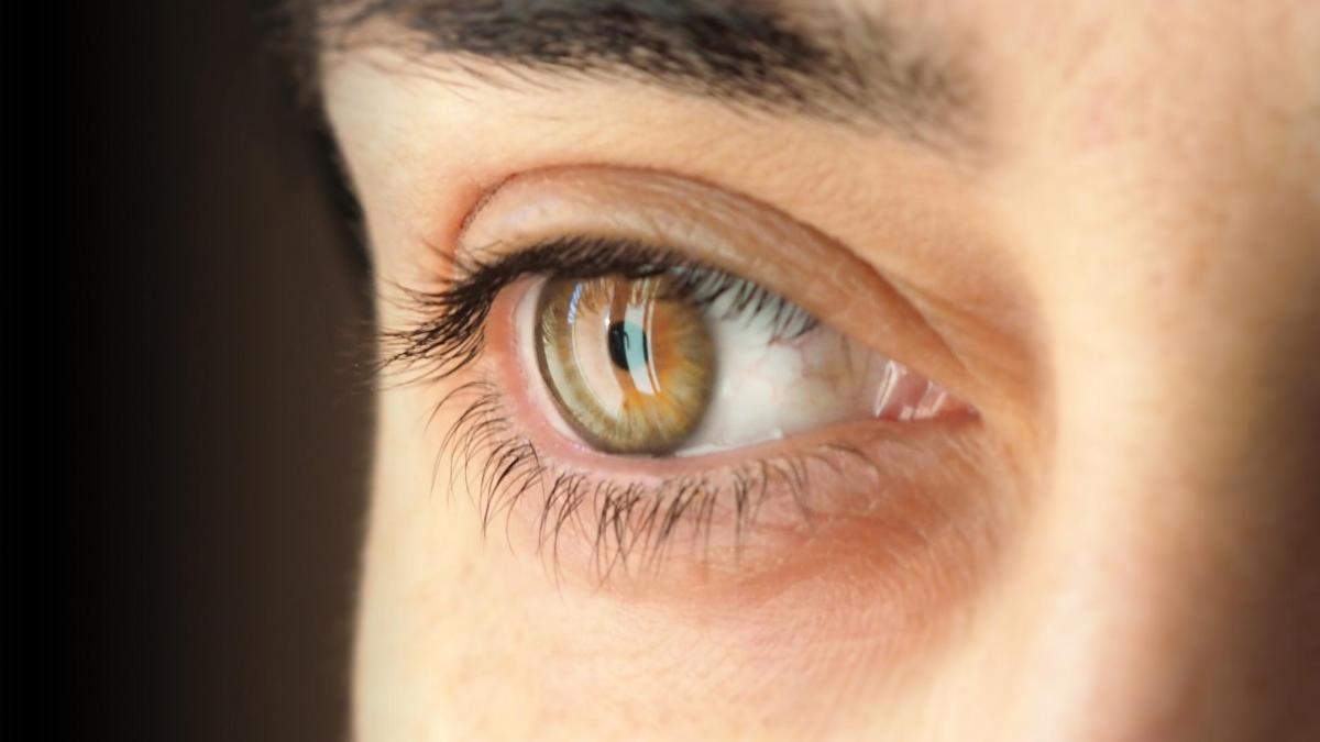 Glaucoma: ¿Cómo afecta tu visión sin que lo sepas?