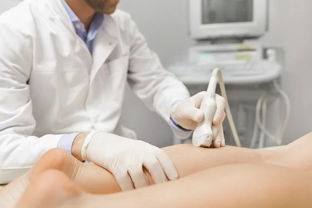 Trombosis: síntomas, tipos y tratamientos que debes conocer