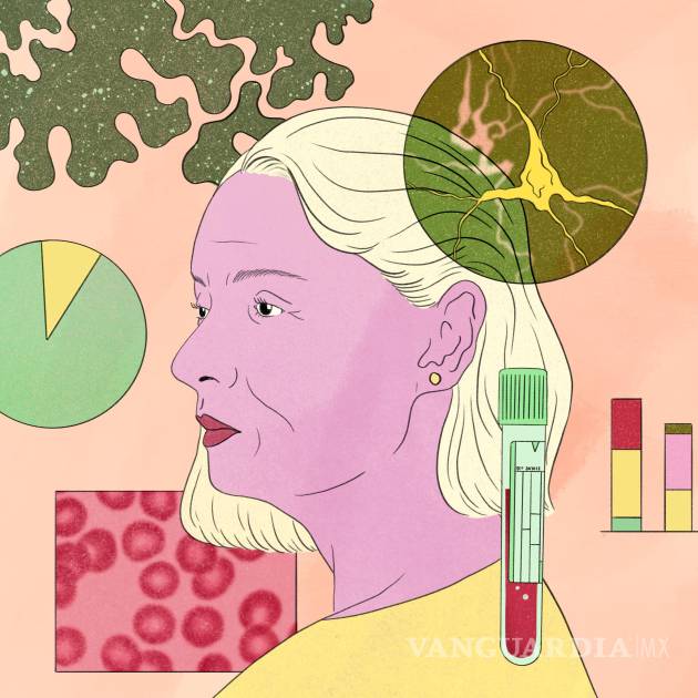Análisis de sangre para Alzheimer: confusión y angustia generada