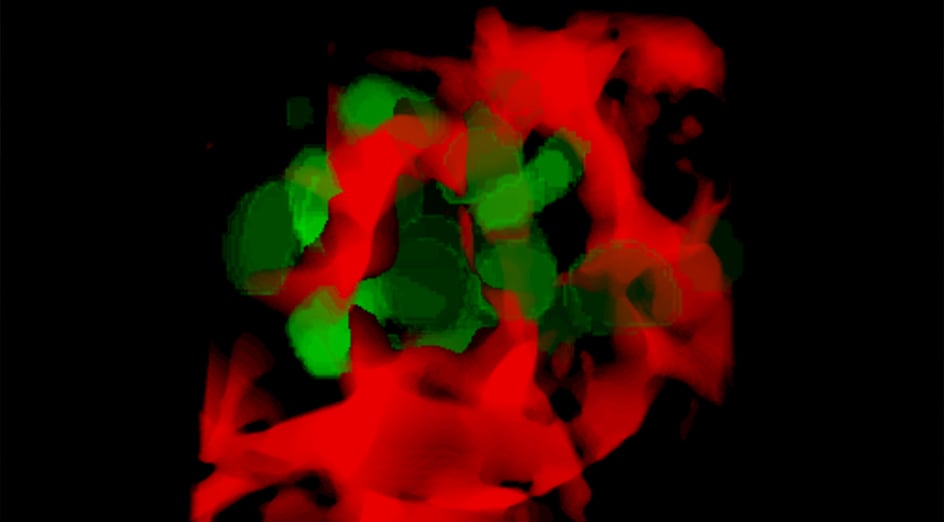 New Model Reveals How Cancer Cells Evade and Spread