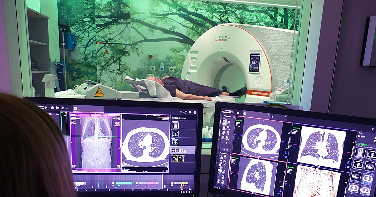Pruebas vitales que los fumadores ignoran para detectar cáncer de pulmón